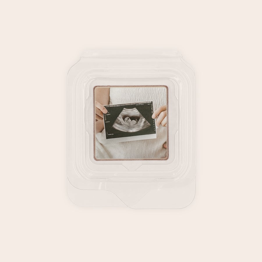 Clear chocolate favour printed with an ultrasound photo for delicious chocolate favours
